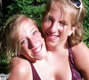 Sexe des jumeaux siamois