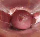 Vigina Porn Pics